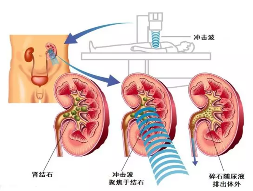 1_副本.png